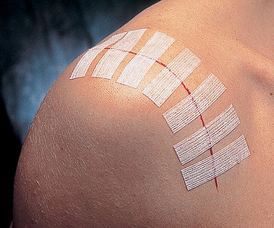 ステリストリップ(TM)スタンダードスキンクロージャー パープル 5本×50袋