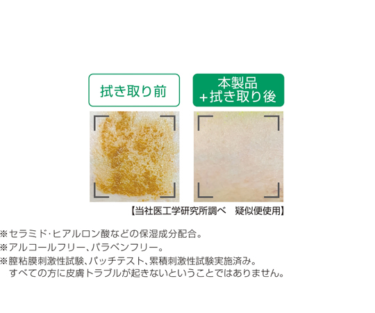 リモイス®泡クレンズ ミニ 200mL 泡立つクリームが出ている状態